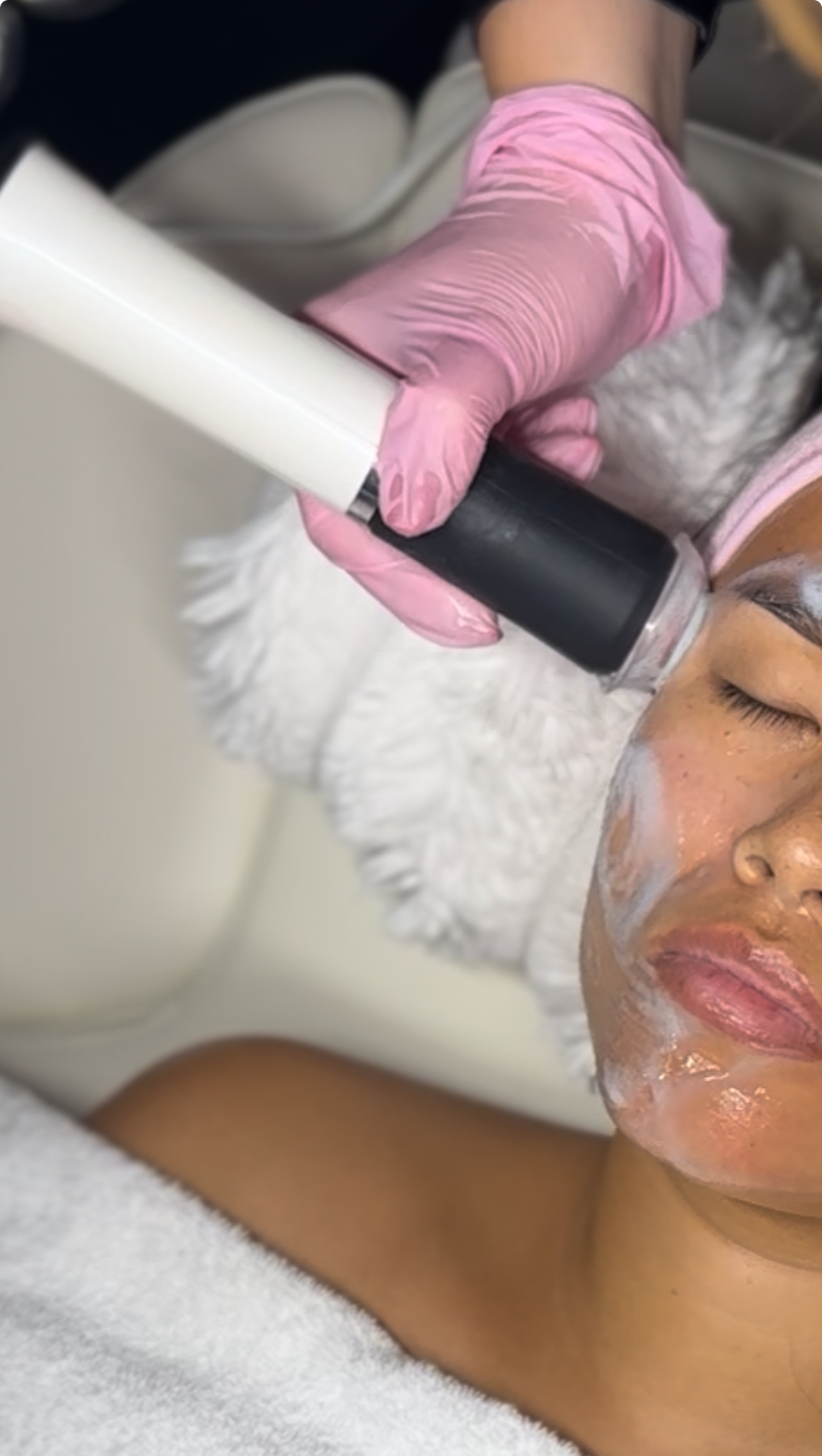PDRN Skin Booster Turnhout | LaserMe