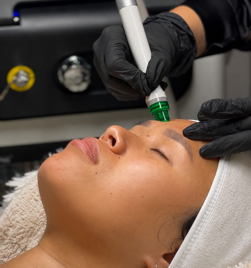 hydra glow peel LaserMe